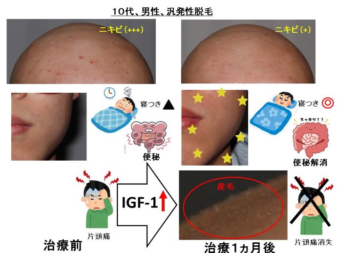 円形脱毛症　病院